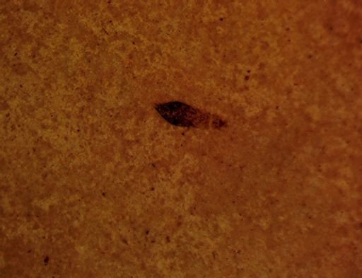 Thysanoptera?