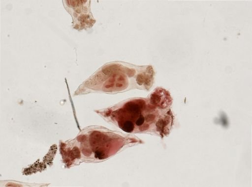 Epiphanes senta