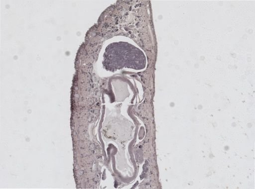 Glossiphonia