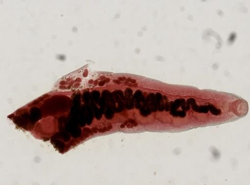 Haematoloechus medioplexus