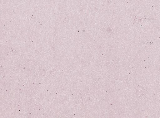 Plasmodium malariae