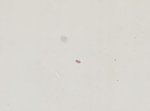 Paramecium polycaryum