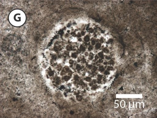Megasphaera miniscula