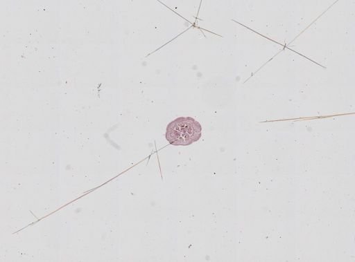Nematostella