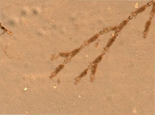 Bryozoa
