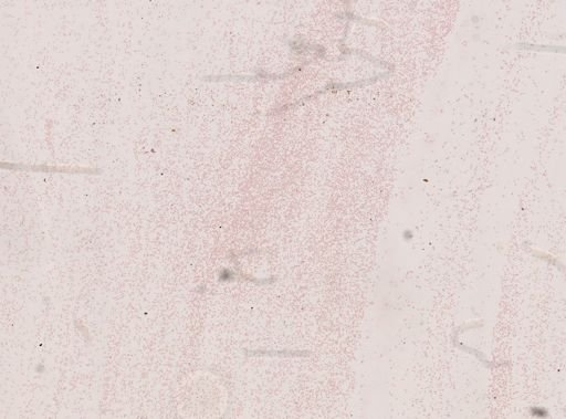 Trypanosoma evansi