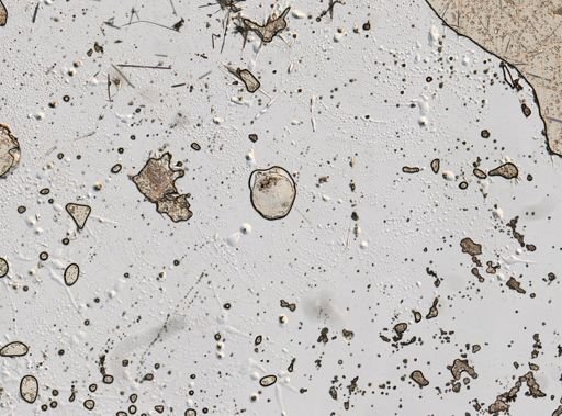 Testudinella patina