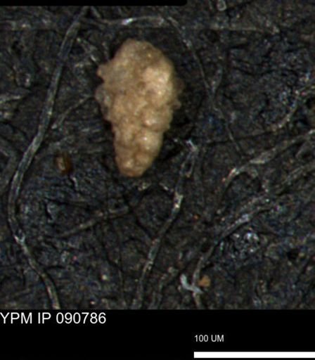 Verneuilina canadensis