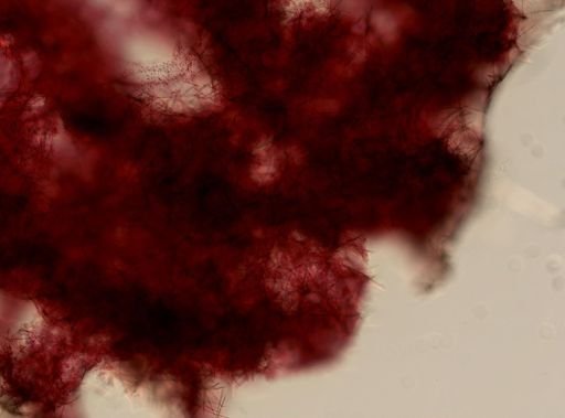 Haliclona