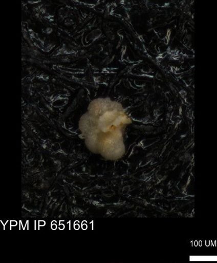 undet. Rugoglobigerinidae