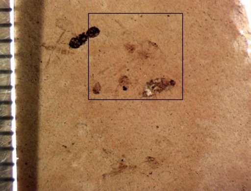 undet. Arachnida