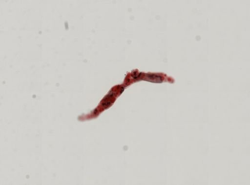 Trematoda