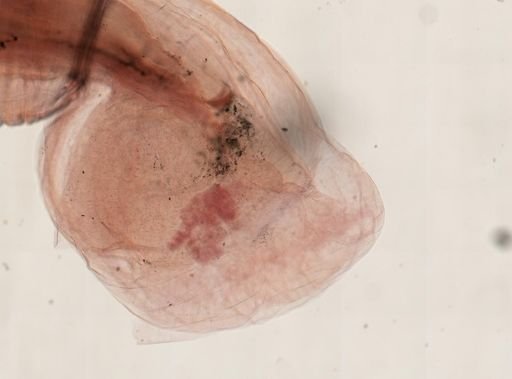 Oligacanthorhynchus microcephalus