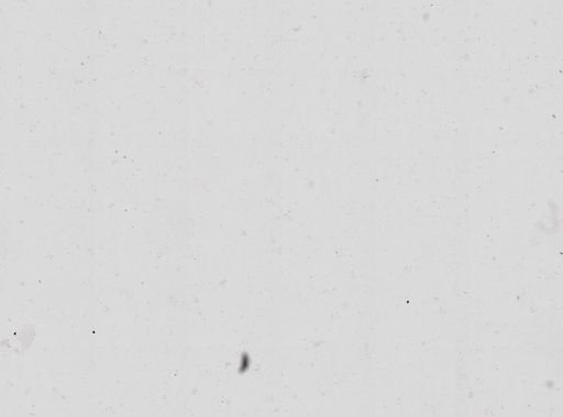 Spirochaeta vincenti