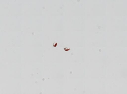 Trematoda