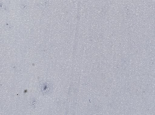 Plasmodium vivax