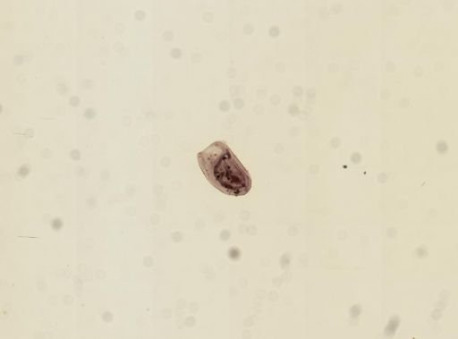 Bursaria truncatella