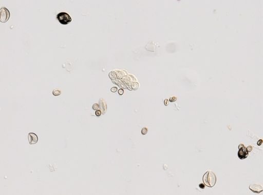 Cestoda
