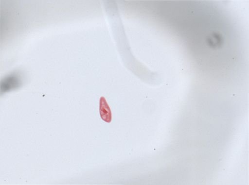 Paramecium aurelia
