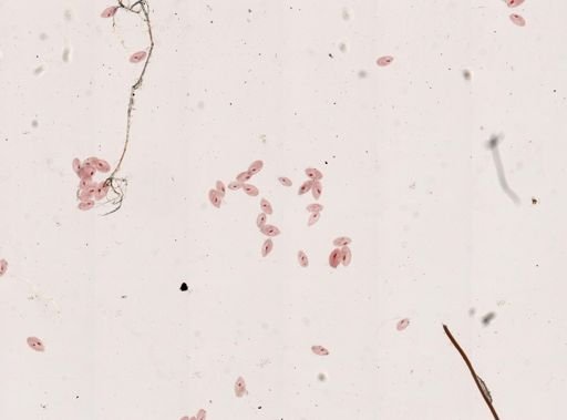 Paramecium aurelia