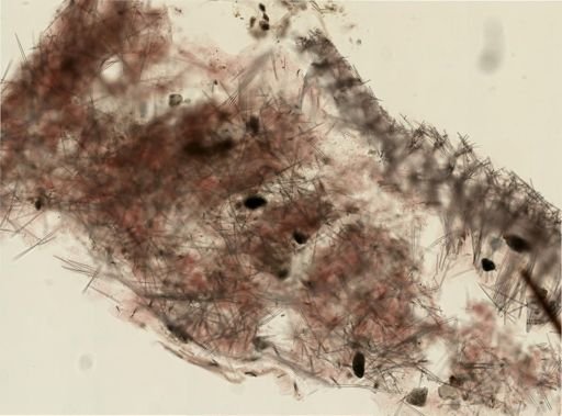 Halichondria panicea
