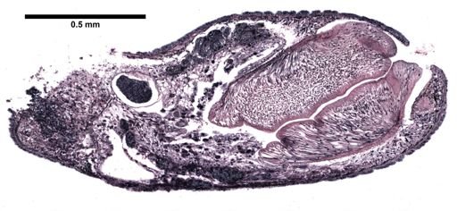 Plagiostomum cinctum