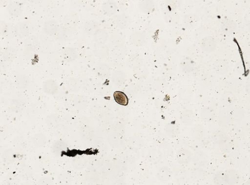 Paragonimus westermani