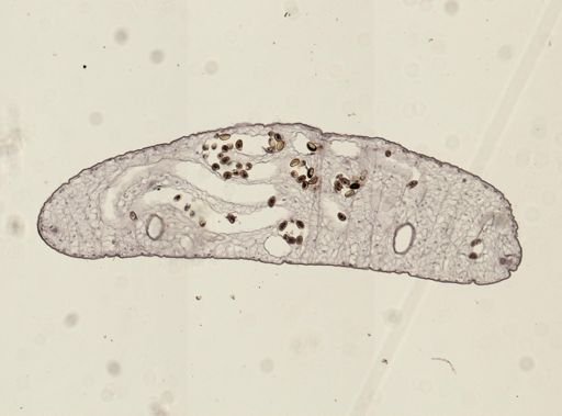 Dicrocoelium dendriticum
