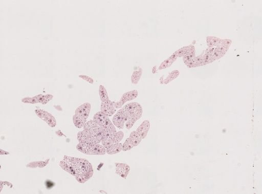 Blattodea