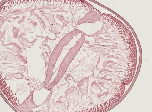 Ascaris lumbricoides