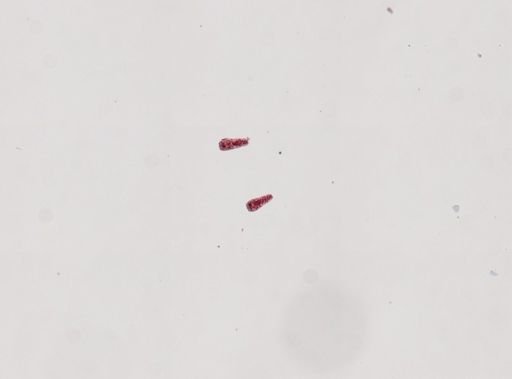 Fasciola hepatica