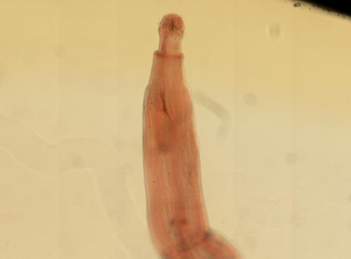 Oligacanthorhynchus microcephalus