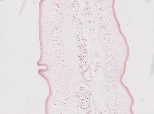 Taenia saginata