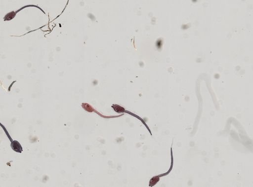 Tunicata