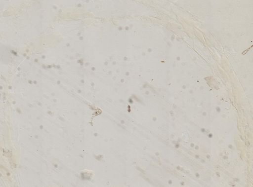 Paramecium