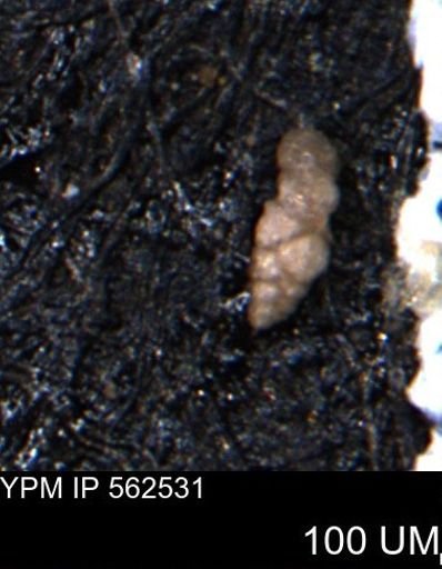 Verneuilina canadensis