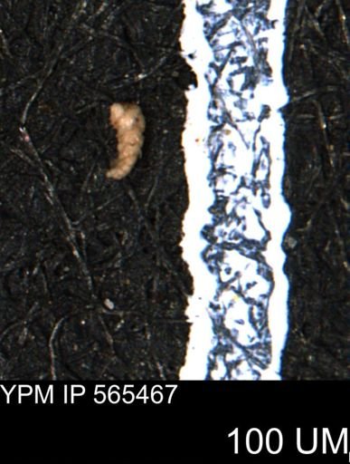 Verneuilina canadensis