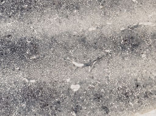 Klossiella muris