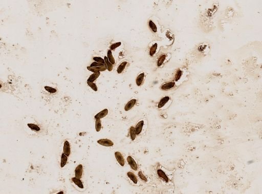 Paramecium caudatum