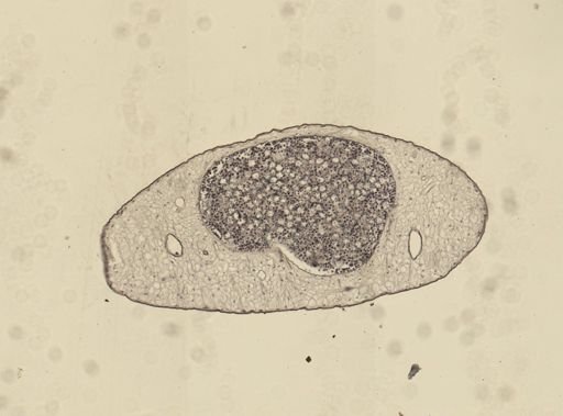 Dicrocoelium dendriticum