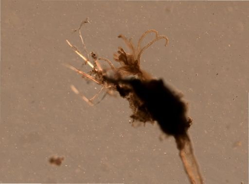 Bryozoa
