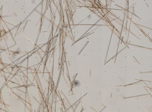 Tethya sp.