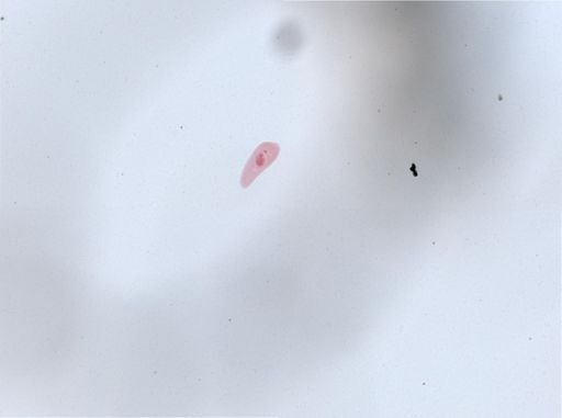 Paramecium aurelia