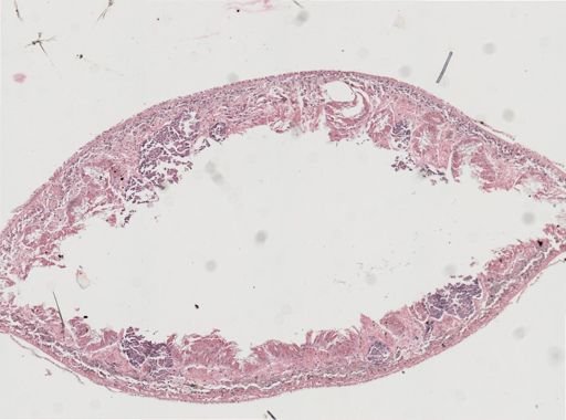 Phagocata gracilis