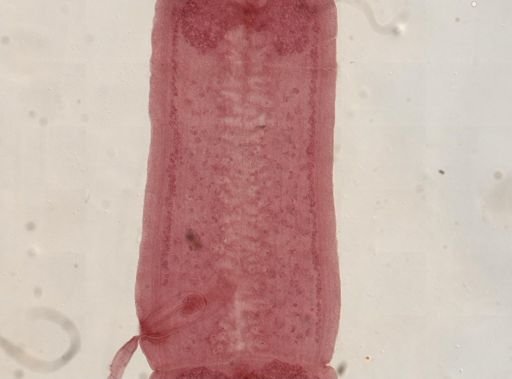 Eucestoda