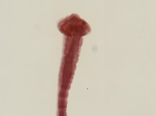 Dipylidium caninum