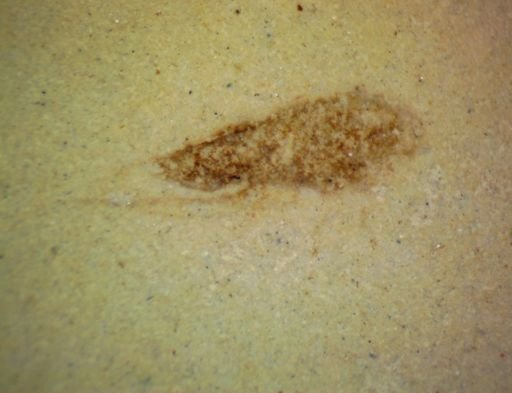 Homoptera?