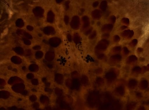 Pleioplana atomata