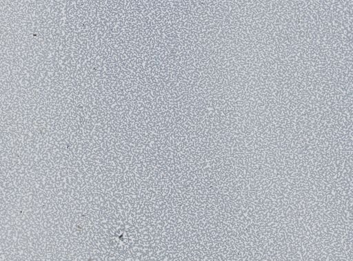Plasmodium vivax