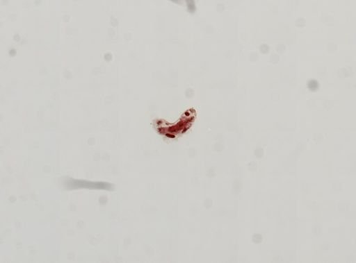 Trematoda